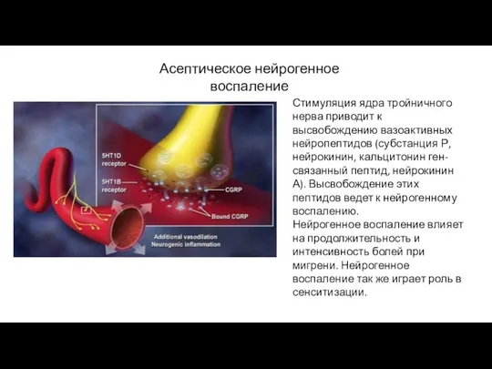 Стимуляция ядра тройничного нерва приводит к высвобождению вазоактивных нейропептидов (субстанция Р,