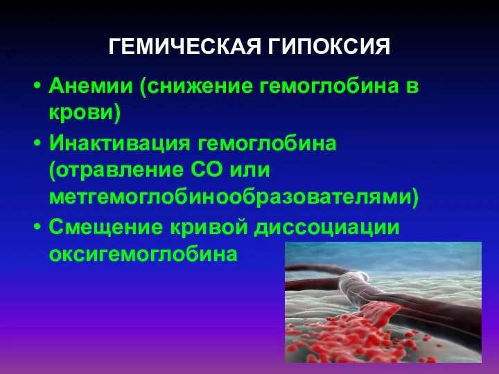 ГЕМИЧЕСКАЯ ГИПОКСИЯ Анемии (снижение гемоглобина в крови) Инактивация гемоглобина (отравление СО