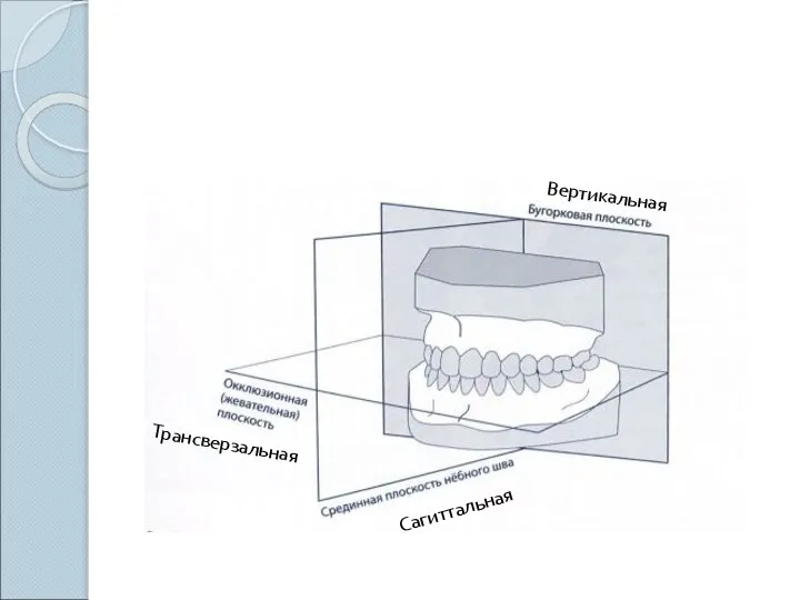 Вертикальная Сагиттальная Трансверзальная