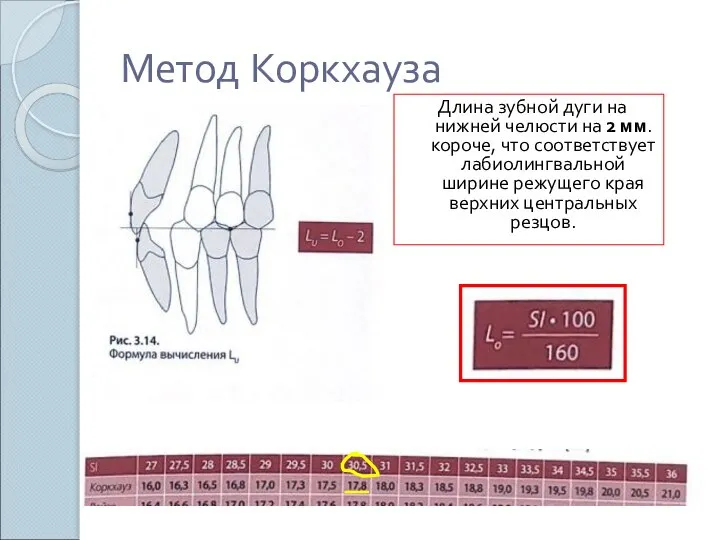 Метод Коркхауза Длина зубной дуги на нижней челюсти на 2 мм.