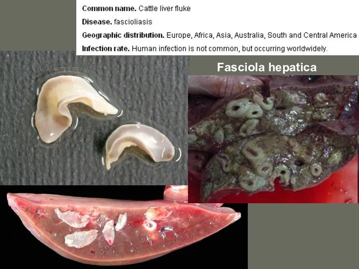 Fasciola hepatica