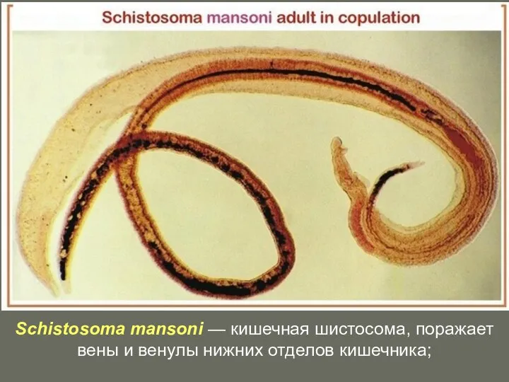 Schistosoma mansoni — кишечная шистосома, поражает вены и венулы нижних отделов кишечника;