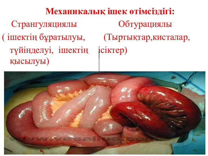 Механикалық ішек өтімсіздігі: Странгуляциялы Обтурациялы ( ішектің бұратылуы, (Тыртықтар,кисталар, түйінделуі, ішектің ісіктер) қысылуы)