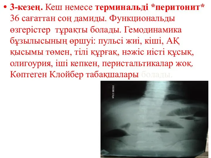 3-кезең. Кеш немесе терминальді *перитонит* 36 сағаттан соң дамиды. Функциональды өзгерістер