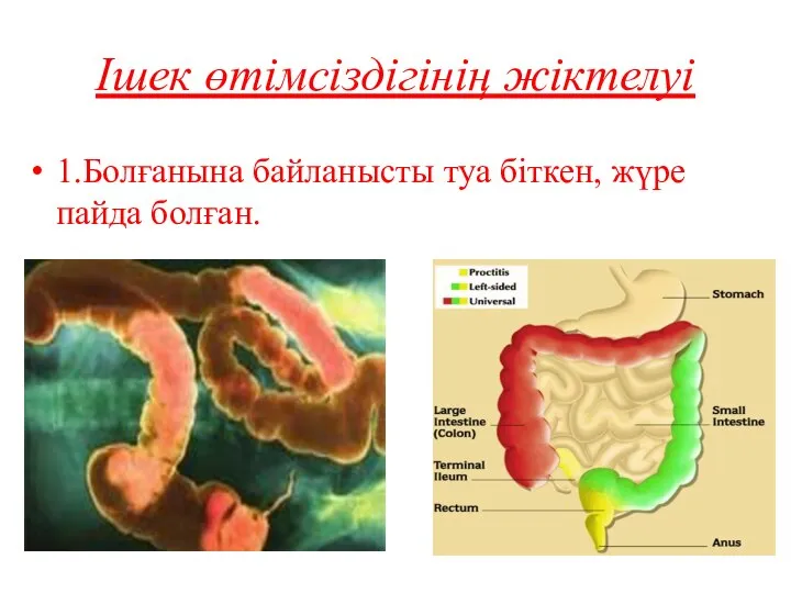 Ішек өтімсіздігінің жіктелуі 1.Болғанына байланысты туа біткен, жүре пайда болған.