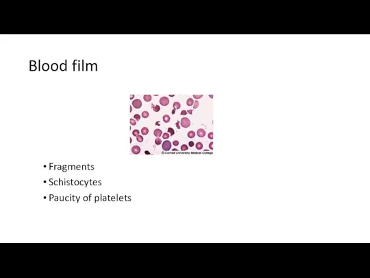 Blood film Fragments Schistocytes Paucity of platelets