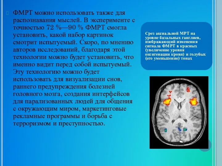 ФМРТ можно использовать также для распознавания мыслей. В эксперименте с точностью