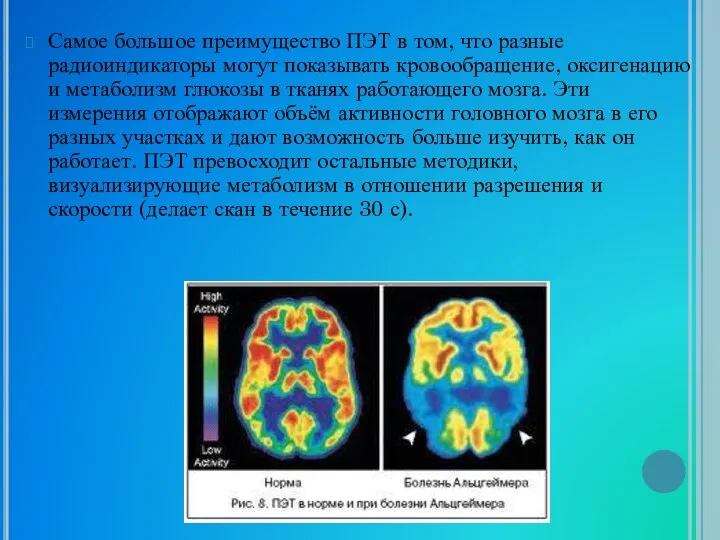 Самое большое преимущество ПЭТ в том, что разные радиоиндикаторы могут показывать