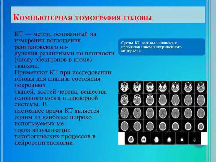 Компьютерная томография головы КТ — метод, основанный на измерении поглощения рентгеновского