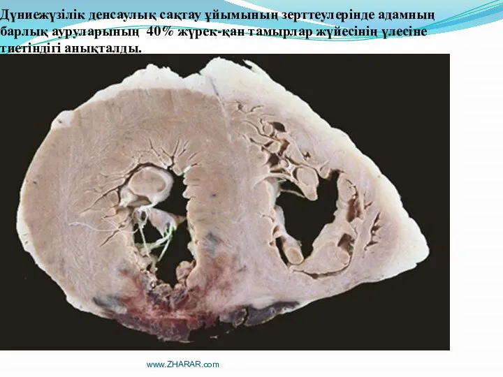 Дүниежүзілік денсаулық сақтау ұйымының зерттеулерінде адамның барлық ауруларының 40% жүрек-қан тамырлар жүйесінің үлесіне тиетіндігі анықталды. www.ZHARAR.com