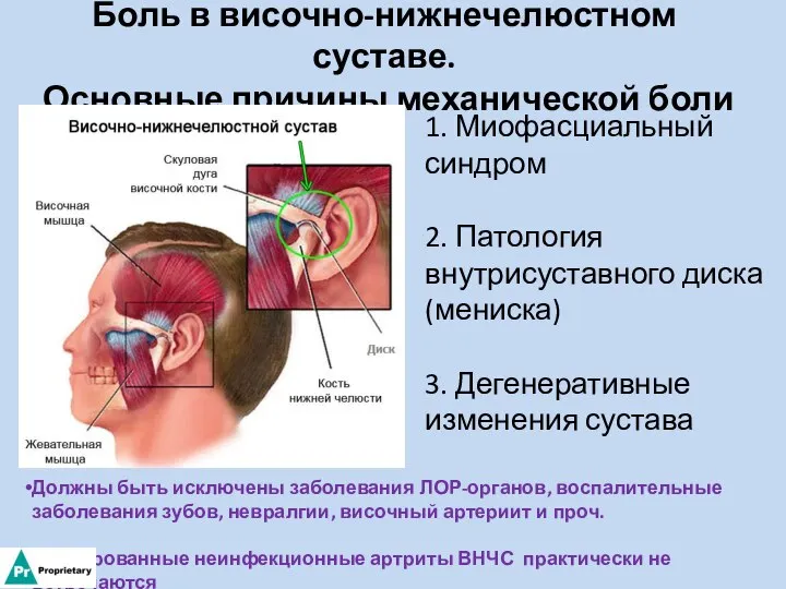 Боль в височно-нижнечелюстном суставе. Основные причины механической боли 1. Миофасциальный синдром