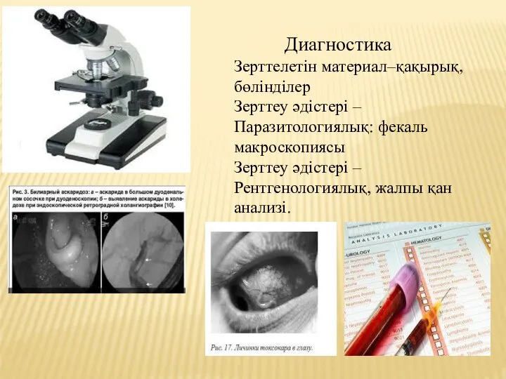 Диагностика Зерттелетін материал–қақырық, бөлінділер Зерттеу әдістері – Паразитологиялық: фекаль макроскопиясы Зерттеу