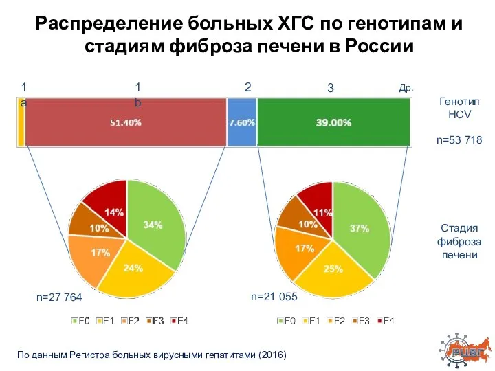 Распределение больных ХГС по генотипам и стадиям фиброза печени в России