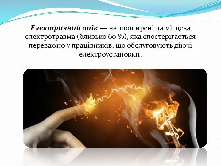 Електричний опік — найпоширеніша місцева електротравма (близько 60 %), яка спостерігається