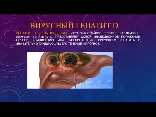 ВИРУСНЫЙ ГЕПАТИТ D ГЕПАТИТ D (ГЕПАТИТ-ДЕЛЬТА) -ЭТО ЗАБОЛЕВАНИЕ ПЕЧЕНИ, ВЫЗЫВАЕМОЕ ВИРУСОМ