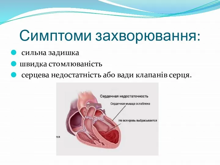 Симптоми захворювання: сильна задишка швидка стомлюваність серцева недостатність або вади клапанів серця.