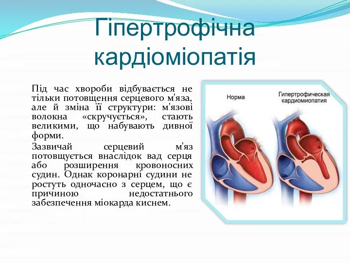 Під час хвороби відбувається не тільки потовщення серцевого м'яза, але й