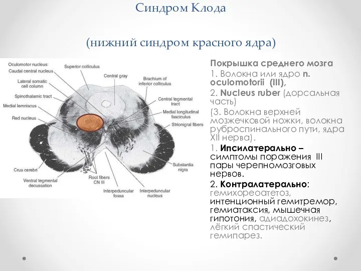 Синдром Клода (нижний синдром красного ядра) Покрышка среднего мозга 1. Волокна