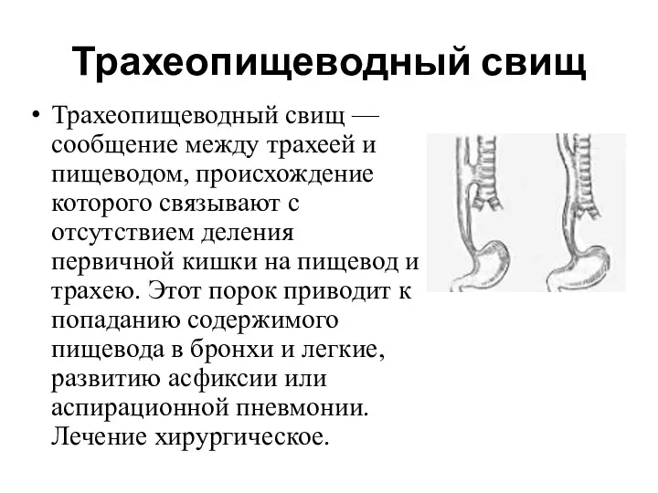 Трахеопищеводный свищ Трахеопищеводный свищ — сообщение между трахеей и пищеводом, происхождение