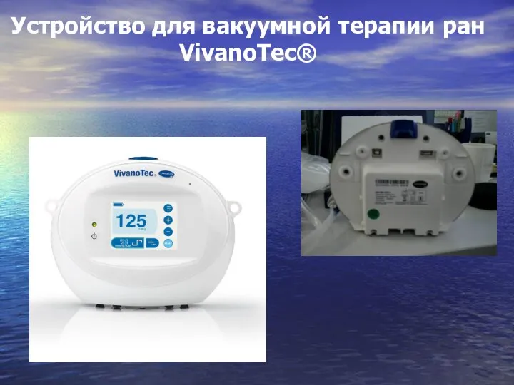 Устройство для вакуумной терапии ран VivanoTec®