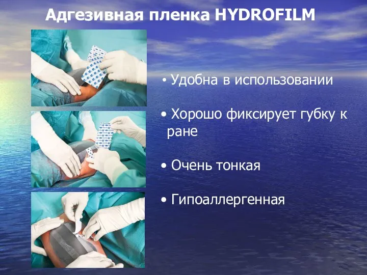 Адгезивная пленка HYDROFILM Удобна в использовании Хорошо фиксирует губку к ране Очень тонкая Гипоаллергенная