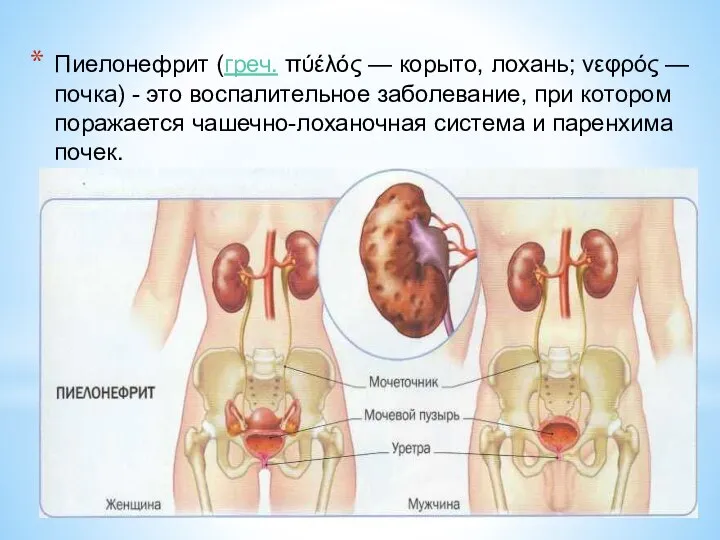 Пиелонефрит (греч. πύέλός — корыто, лохань; νεφρός — почка) - это