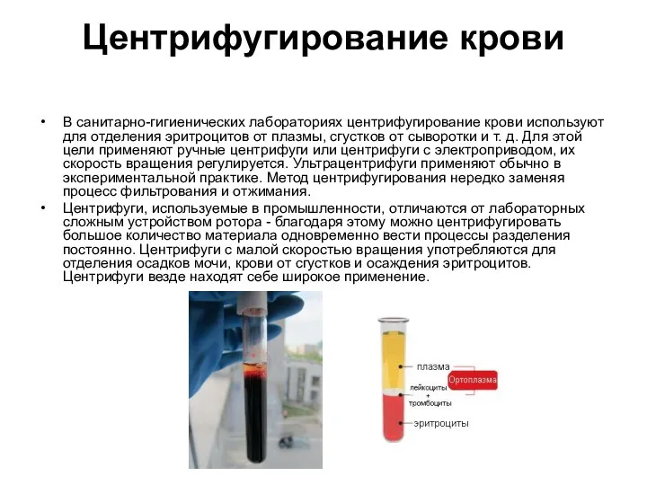 Центрифугирование крови В санитарно-гигиенических лабораториях центрифугирование крови используют для отделения эритроцитов