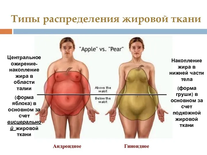 Типы распределения жировой ткани Центральное ожирение- накопление жира в области талии