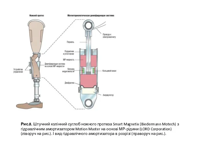 Рис.8. Штучний колінний суглоб ножного протеза Smart Magnetix (Biedermann Motech) з