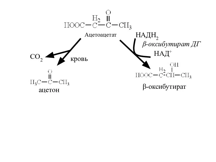 Ацетоацетат β-оксибутират ацетон СО2 кровь НАДН2 НАД+ β-оксибутират ДГ