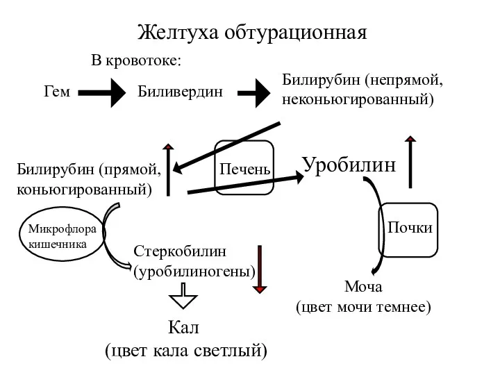 Печень Желтуха обтурационная Билирубин (непрямой, неконьюгированный) Моча (цвет мочи темнее) В