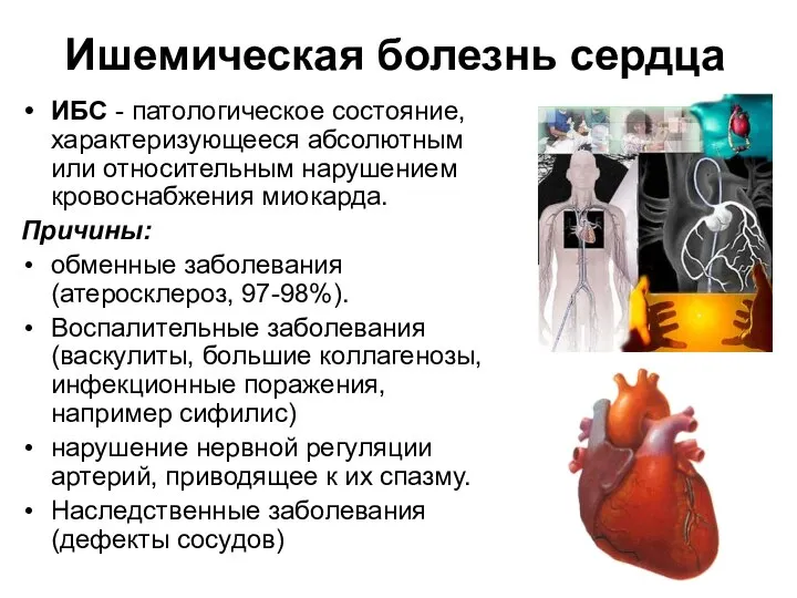 Ишемическая болезнь сердца ИБС - патологическое состояние, характеризующееся абсолютным или относительным