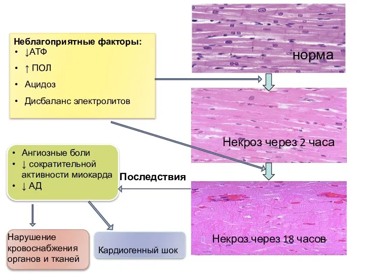норма Некроз через 2 часа Некроз через 18 часов Неблагоприятные факторы: