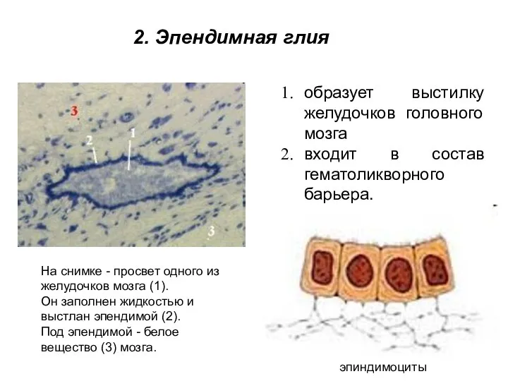 образует выстилку желудочков головного мозга входит в состав гематоликворного барьера. На