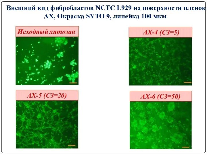 Внешний вид фибробластов NCTC L929 на поверхности пленок АХ, Окраска SYTO 9, линейка 100 мкм