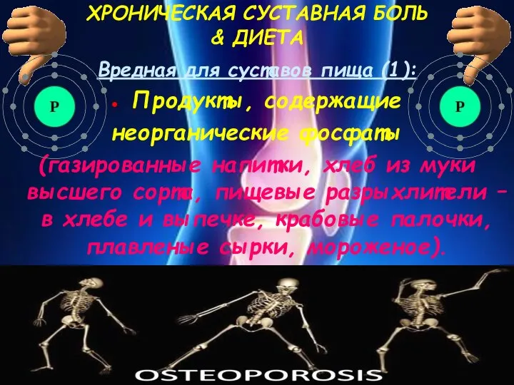 ХРОНИЧЕСКАЯ СУСТАВНАЯ БОЛЬ & ДИЕТА Вредная для суставов пища (1): Продукты,