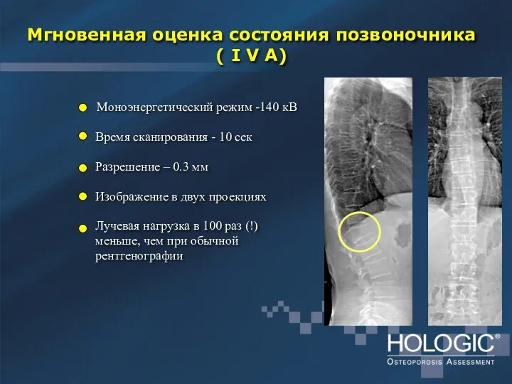 Мгновенная оценка состояния позвоночника ( I V A) Моноэнергетический режим -140