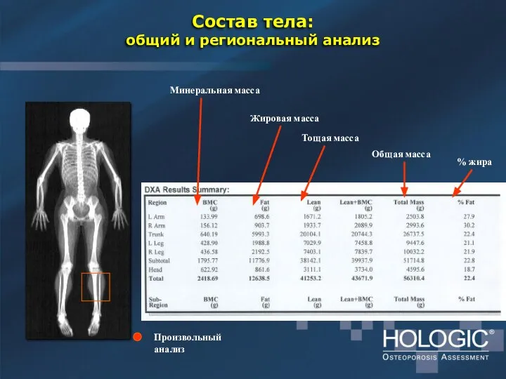 Состав тела: общий и региональный анализ Минеральная масса Жировая масса Тощая