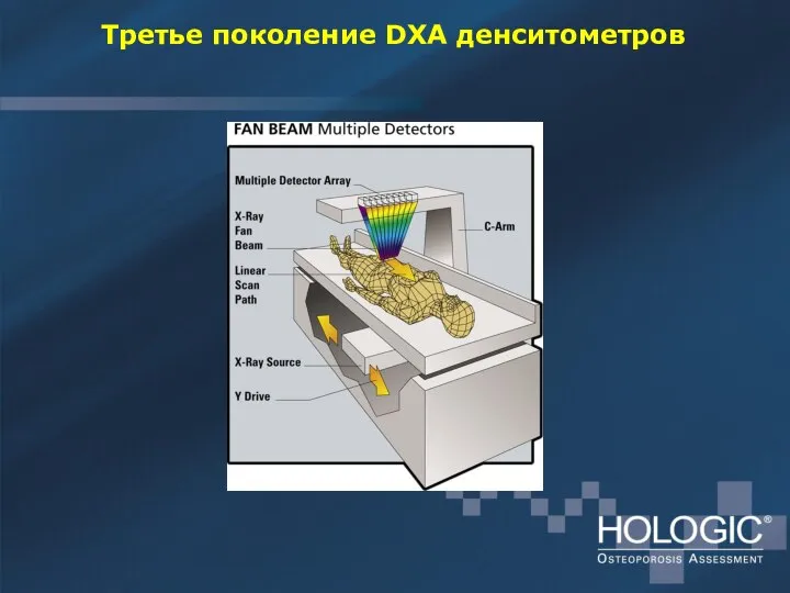 Третье поколение DXA денситометров