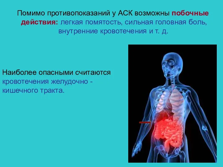 Помимо противопоказаний у АСК возможны побочные действия: легкая помятость, сильная головная