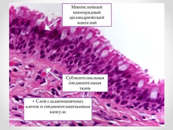 + Слой гладкомышечных клеток и соединительнотканная капсула Многослойный многорядный цилиндрический эпителий Субэпителиальная соединительная ткань