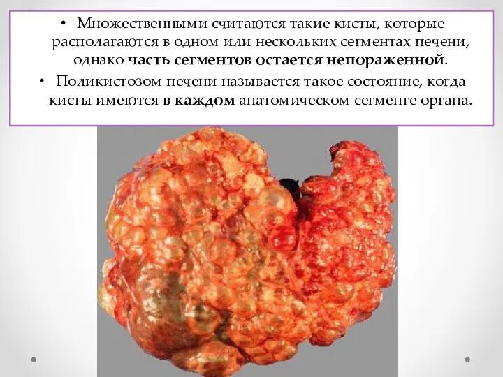 Множественными считаются такие кисты, которые располагаются в одном или нескольких сегментах