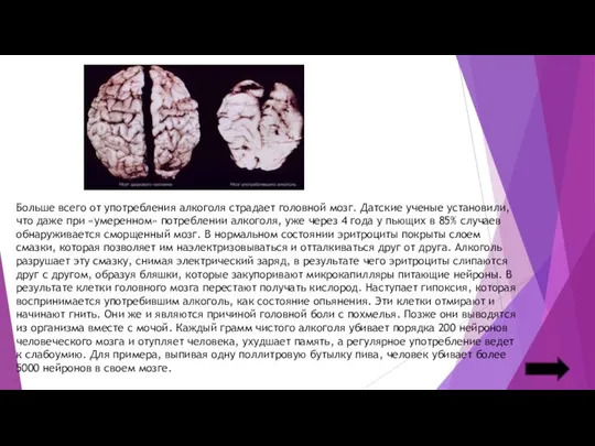 Больше всего от употребления алкоголя страдает головной мозг. Датские ученые установили,