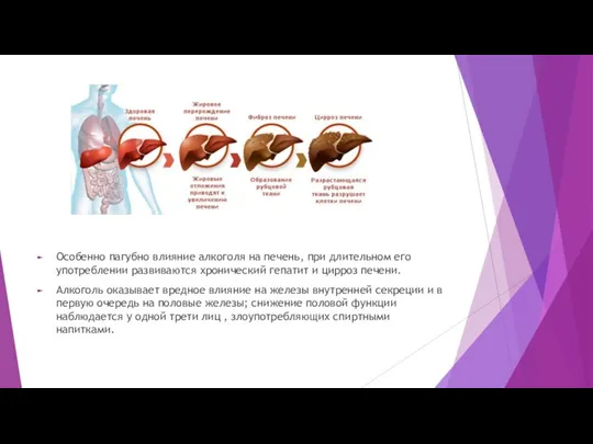 Особенно пагубно влияние алкоголя на печень, при длительном его употреблении развиваются