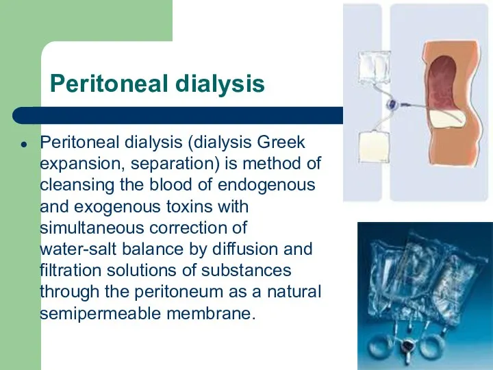 Peritoneal dialysis Peritoneal dialysis (dialysis Greek expansion, separation) is method of