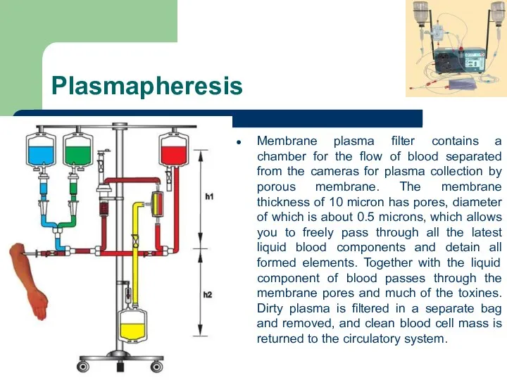 Plasmapheresis Membrane plasma filter contains a chamber for the flow of