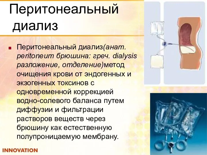 Перитонеальный диализ Перитонеальный диализ(анат. peritoneum брюшина: греч. dialysis разложение, отделение)метод очищения