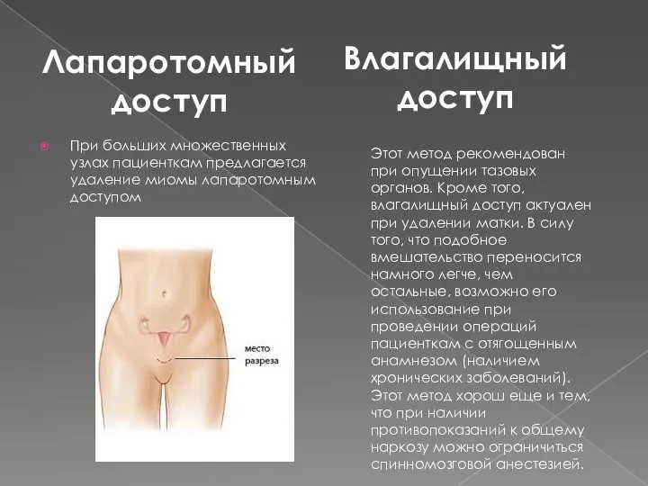 При больших множественных узлах пациенткам предлагается удаление миомы лапаротомным доступом Лапаротомный