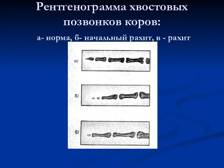 Рентгенограмма хвостовых позвонков коров: а- норма, б- начальный рахит, в - рахит