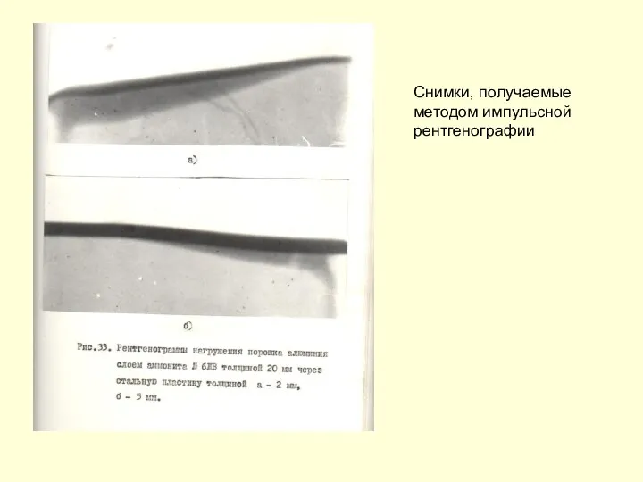 Снимки, получаемые методом импульсной рентгенографии